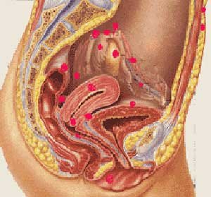 子宫内膜异位症状