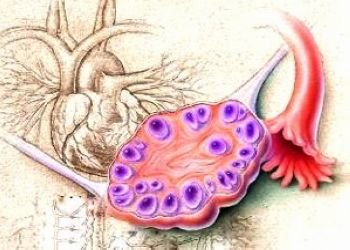 卵巢囊肿的症状有哪些