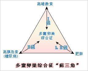 多囊卵巢综合症病因