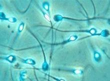 精子质量不好怎么治疗呢