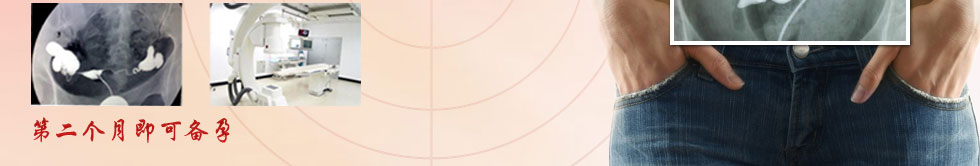 输卵管造影 更快速 更准确